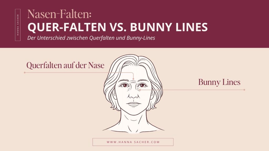 Nasenfalten Unterscheidung: Querfalten auf der Nase vs. Bunny Lines